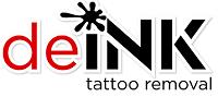 DeINK Tattoo Removal image 1