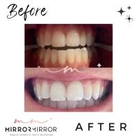 Mirror Mirror Mobile Teeth Whitening image 7