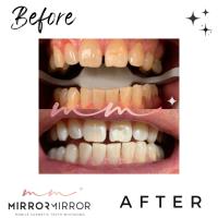 Mirror Mirror Mobile Teeth Whitening image 13