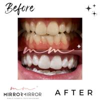 Mirror Mirror Mobile Teeth Whitening image 11