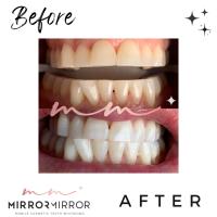 Mirror Mirror Mobile Teeth Whitening image 17