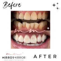Mirror Mirror Mobile Teeth Whitening image 18