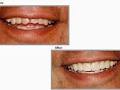 Apex Dental image 4