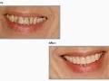 Apex Dental image 5