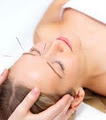 Auckland Wellness Centre - Acupuncture Therapy image 1