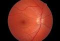 Esposito Eyesite Optometrists image 1