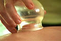 Essential Healing Ltd. Acupuncture, Massage & Herbs image 4