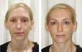 Permanent Makeup Clinic image 3