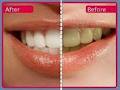 Sparklewhite Teeth Ltd image 3