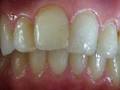 Sparklewhite Teeth Ltd image 4
