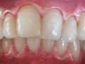 Sparklewhite Teeth Ltd image 1