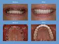 Wellington Dentists Ltd image 2