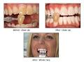 Wellington Dentists Ltd image 3