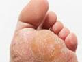 Healthy Steps Podiatry - St Heliers image 4