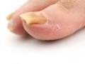 Healthy Steps Podiatry - St Heliers image 1