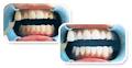 Teeth Whitening Associates image 4