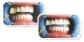 Teeth Whitening Associates image 5
