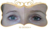 Hollywood Eyes Permanent Makeup image 8