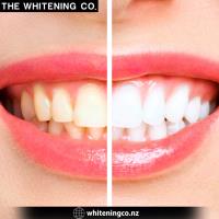 The Whitening Co image 3