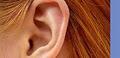 Hearing Technology  image 4