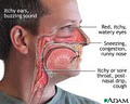 Allergy Analysis image 3