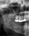 Auckland Dentist - The Perfect Dentist in Auckland image 1