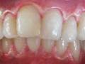 Sparklewhite Teeth Ltd logo