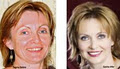 laser lifeCARE institute image 3